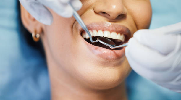 Best Pediatric Emergency Dentist in Huber Ridge, OH