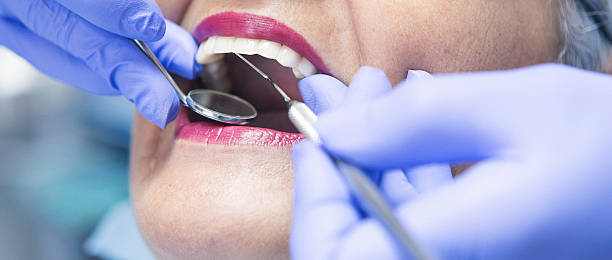 Best Emergency Dental Services for Seniors in Huber Ridge, OH